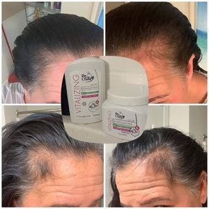 GARLIC KIT FOR HAIR GROW